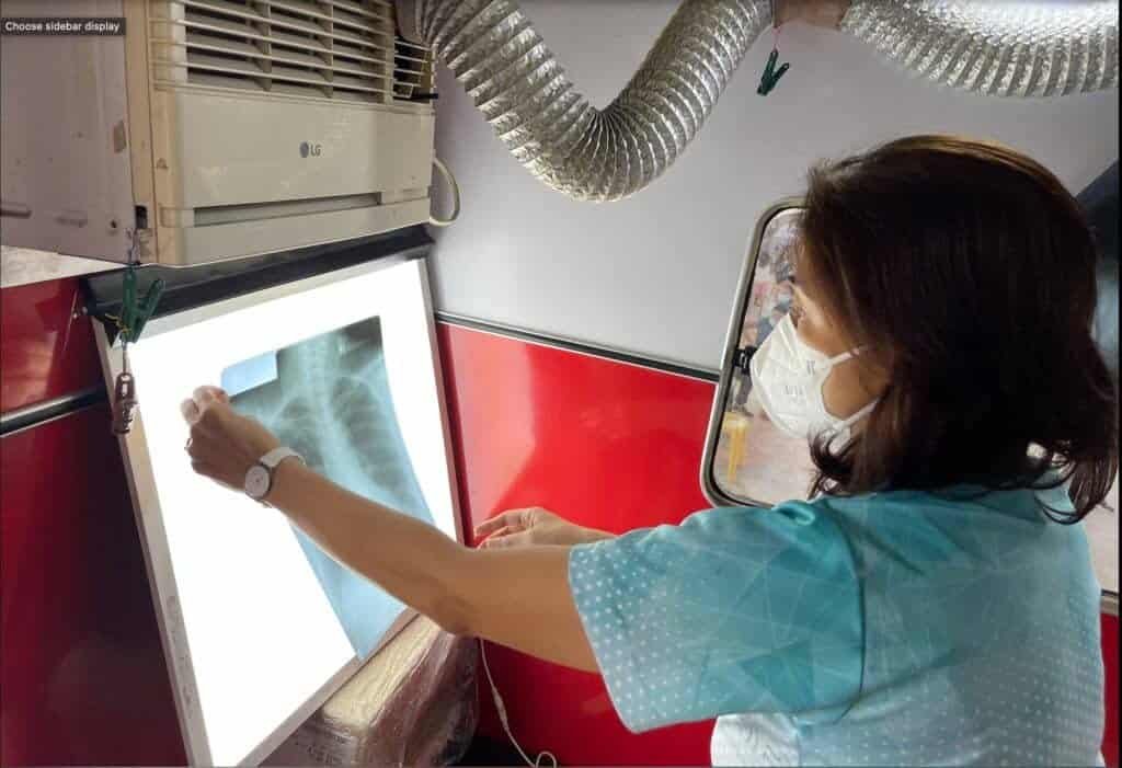 Culion Foundation and PBSP’s First TB-ACF Program in Masbate Screens Over 4,000 Patients, Prioritizing Vulnerable Groups